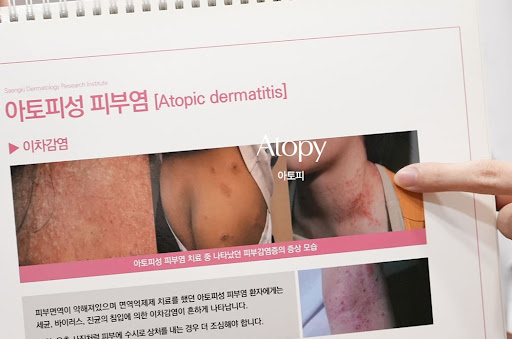 생기한의원으로 알아보는 소아 아토피 가려움 관리 기본 내용